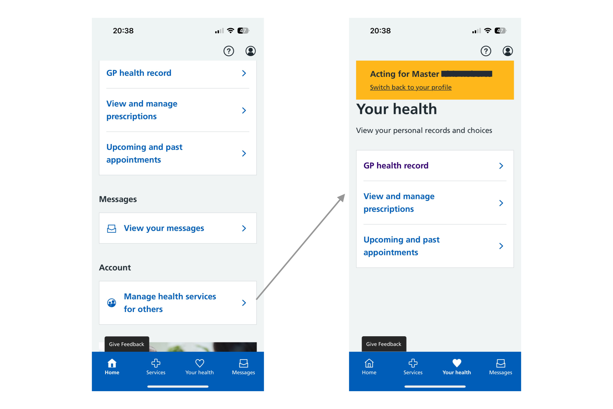 Two screenshots from the NHS App, the first one showing a button labelled 'Manage health services for others', which is linked by an arrow to a second screenshot showing a yellow banner at the top containing 'Acting for Master [censored]' with a link to 'switch back to your profile'. Underneath the yellow banner is the page title 'Your health'